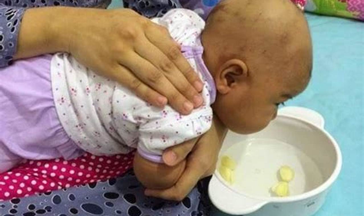 Cara Mengatasi Batuk Berdahak Pada Bayi